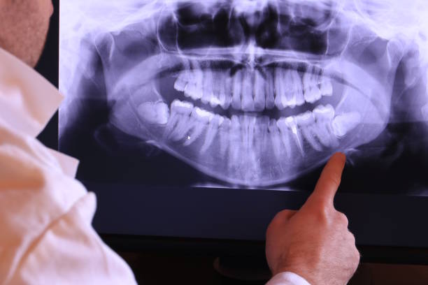 Best Emergency Dental Services for Seniors in Post, TX