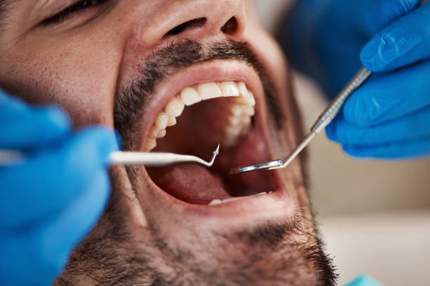 Best Broken or Cracked Tooth Emergency Dentist in Post, TX